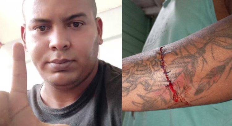 atacan-con-arma-blanca-a-activista-cubano-alejandro-garlobo