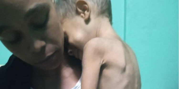 madre-cubana-pide-ayuda-para-su-nino-enfermo-y-desnutrido